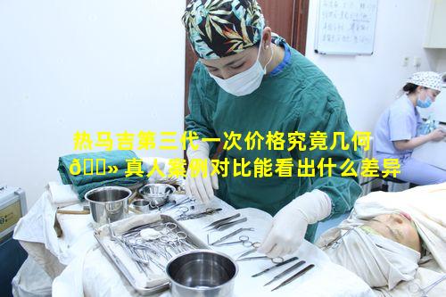 热马吉第三代一次价格究竟几何 🌻 真人案例对比能看出什么差异呢